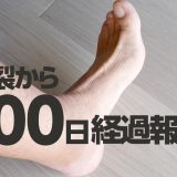 アキレス腱断裂から100日目の経過報告